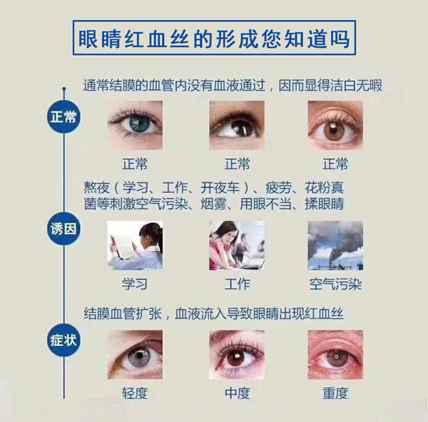 红血丝的形成