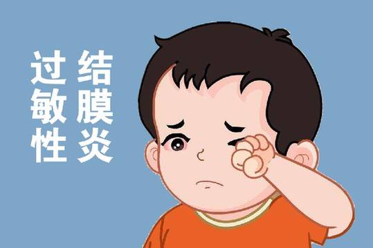过敏性结膜炎