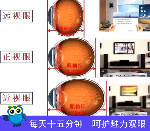 近视眼有没有风险 石斛手机眼贴